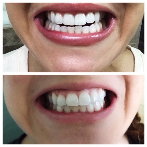 Whitening toothpaste - Picture 3 of 4